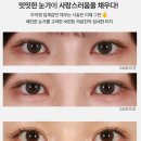 크림성형외과의원 이미지