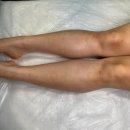면목동-070 | 상봉] 상봉왁싱 안아프게 잘하는곳 &lt;마취왁싱&gt; | 아토피피부 생애 첫 왁싱 후기 | 망우동왁싱 면목동왁싱
