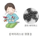 장염에 걸렸을 때 원인별 증상 차이점과 대처 방법 이미지