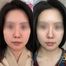 진갈매 | 갈매 피부관리 약손명가 구리갈매점에서 k뷰티 연예인관리 받은 후기