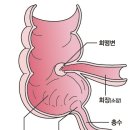 ﻿대장 구조 이미지