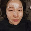 비알팜 | 리쥬란아이 일주일 후 후기, 리즈네 리제반 2cc 후기 PN주사 총정리