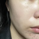 (주)릴렉스퍼시픽 | 메이크온 LED 마스크 2주체험 찐후기 | 피부장벽 끌어올리기 프로젝트!