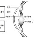 아이피아안경 이미지