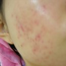 함초롬피부과의원 이미지