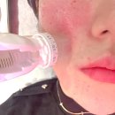 오늘의한의원 | 강남역 피부관리 한의원 기미색소 컨택터 효과 후기