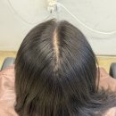 서울대입구역 미용실 추천｜가르마 비침 해결! 라비살롱 링거펌·한올증모술 솔직후기
