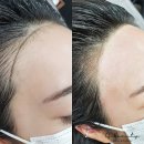 수원 영통헤어라인 세종뷰티추천~(후기)