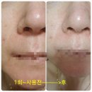 루미 스파 피트니스 이미지