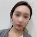 땅콩약국 | 삼성역피부과 땅콩형 얼굴 볼꺼짐 시술 T1하이브리드 내돈내산 찐 후기