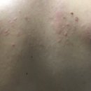 홍희한의원 네이버블로그