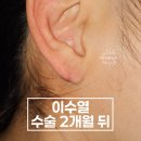 강동실비 이미지