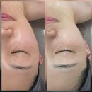 장달훈파동에너지연구소 | 동해 피부관리 김서이피부연구소 케라손 1회 관리로 잡티 모공 고민 해결