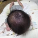 감청수병원 | 경남 김해 사두증 상담 치료 후기 (한솔 재활요양병원)