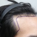 모나라피부과의원 이미지