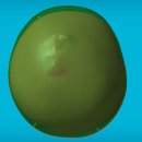 지오엠디 | [두상교정] 강동 지오 헬멧, 두상 교정 헬멧 후기, 단두 교정 95%에서 89%로