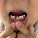 이편한연세치과의원 | 구리 교문동 어린이치과 추천, 6세 아들 검진 후기 (서울이편한치과의원)
