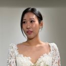 청담엔샤인의원 | 노원역 피부과 추천 튠페이스 부작용 없는 리프팅