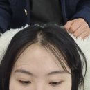 [박미증모가발] 인천헤어증모술 전문점 방문후기