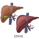 간이식 후 상태(Liver Transplantation status) 이미지