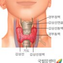 갑상선암의 발생부위 이미지