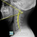 세란의원 네이버블로그