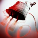 자가수혈[autologous transfusion] 이미지