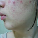 필소프트 이미지