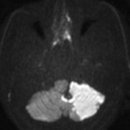 서울브레인신경과의원 이미지