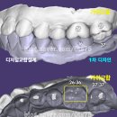 윤디지털치과기공소 이미지