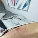 숄더댄스 이미지