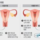 수정-2 이미지