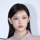 팅커벨 | 요정귀필러 귓바퀴필러 팅커벨필러 후기 효과 통증 부작용 장점 단점