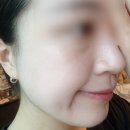 에이스팩(주) - 35002 | 🍋essL 에슬 _기미팩, 기미마스크팩🍋