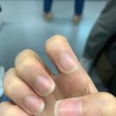 희쁨네일
