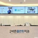 덴탈플란트 이미지