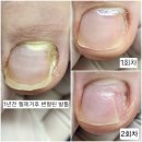 케이큐어 이미지