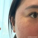인메디코리아 | 잠실 에스테틱 피부관리 데자뷰메디스킨 피부 장벽 복구