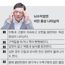 요즘 용어---- 알고나 지냅시다--22-- 수막구균성 수막염이란???. 초기 증상은 감기와 비슷…사망률 10~14%" 충격 이미지