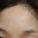 티존 | 라보타치 티존 에이지 패치 후기｜미간세로주름 이마주름패치 주름패치 추천