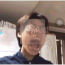 함박약국 | 내 현생을 조져놓은 사랑니 염증 .. 그리고 매복사랑니 두개 발치 후기 (마곡발산 세상모든사랑니치과의원)