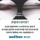 관절내시경 간단한 시술로 치료하는 무릎연골수술 – 반월상연골판파열의 절제술과 봉합술 :)웰튼병원 이미지