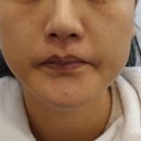 아이필유의원 이미지