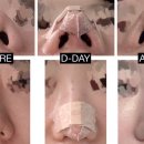 서울퀸성형외과의원 이미지