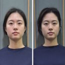 대봉동 "위드밸런스뷰티" 두골비 비대칭관리 후기