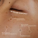 글로우에스테틱 이미지
