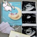 인랩솔루션 | 임산부엽산 임신초기종합영양제 마더스밸런스1