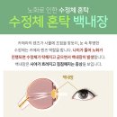 아이준안과 이미지