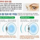 더 스토리 안경콘택트 이미지