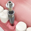 율하위치과의원 이미지